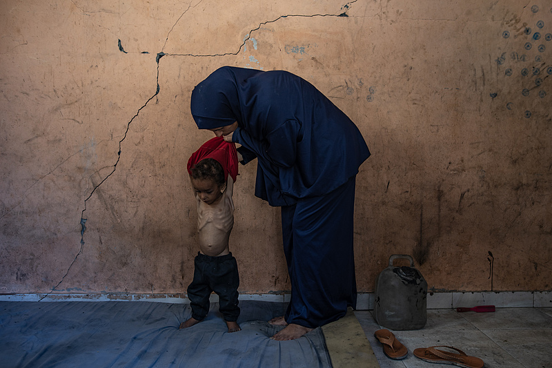 WHO: Gaza Menghadapi 'Kelaparan Massal' Buatan Manusia, Kematian Akibat Kelaparan Meningkat