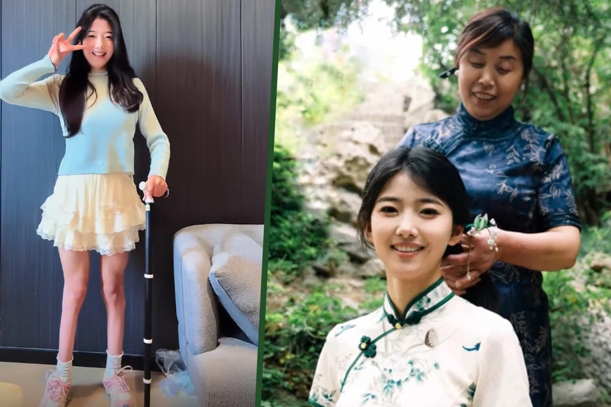 Liu berjalan dengan gaya berjalan tidak stabil karena atrofi otot di tungkai bawah dia dengan sayang menyebut dirinya Waiwai yang berarti 'bengkok'